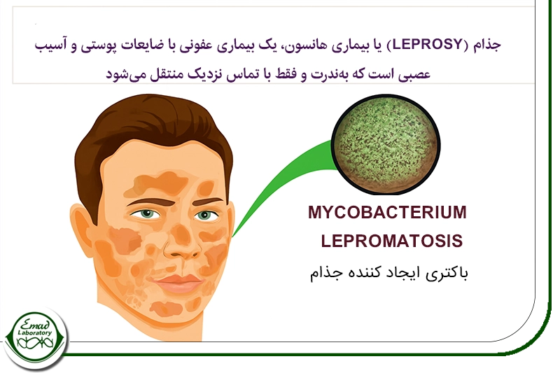 بیماری های گرانولوماتوز دیگر