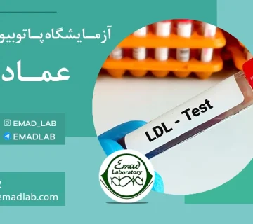 ldl