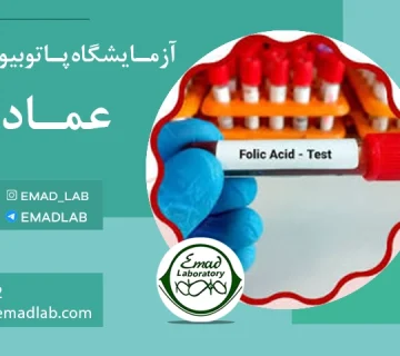 Folic acid test