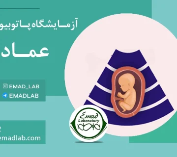 Prenatal screening