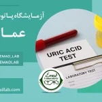 Uric acid test