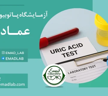 Uric acid test