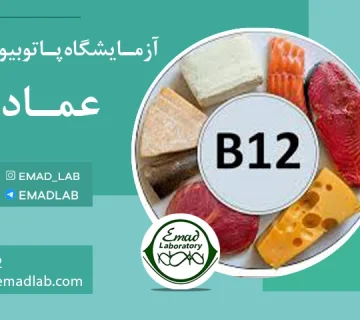Vitamin B12 test