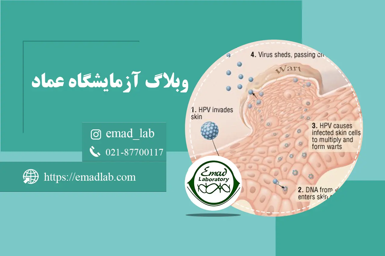 The cause of genital warts