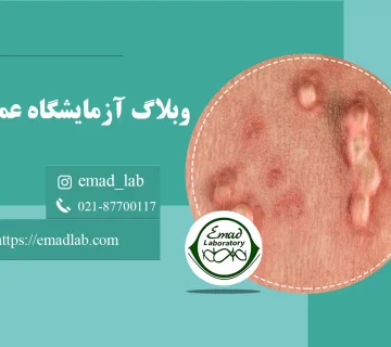 Types of genital warts