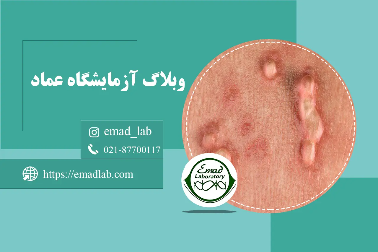 Types of genital warts