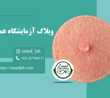 What is the cause of genital warts