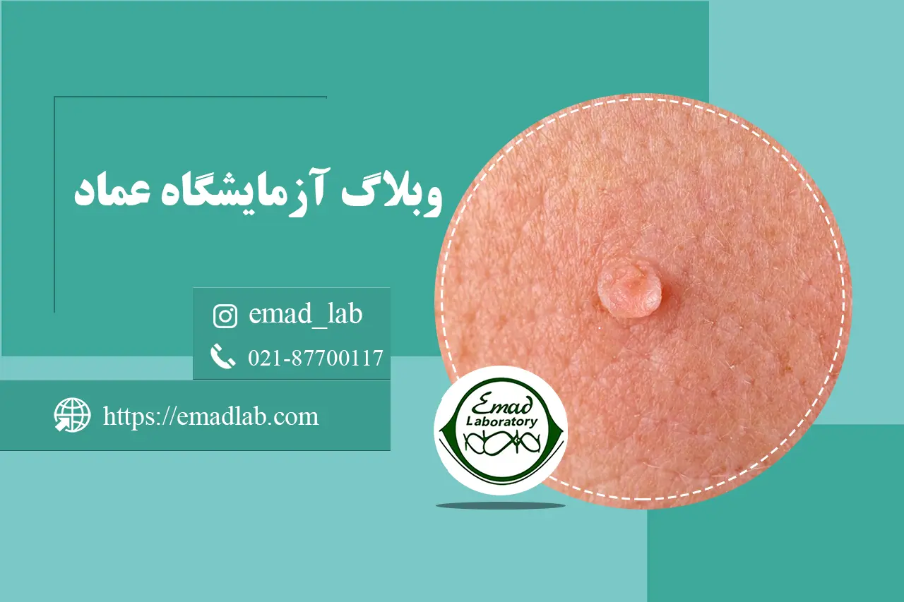 What is the cause of genital warts