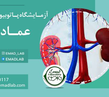 آزمایش-کلیه