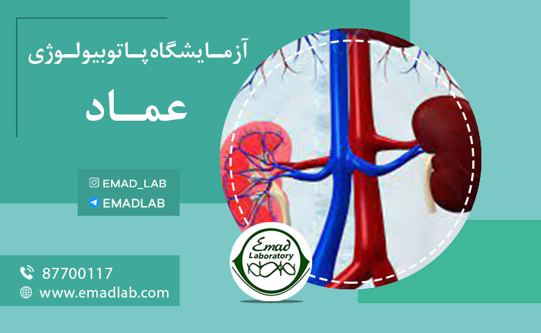 آزمایش کلیه