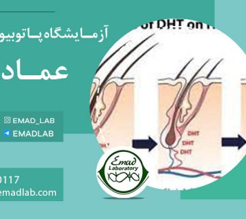 ازمایش-ریزش-مو