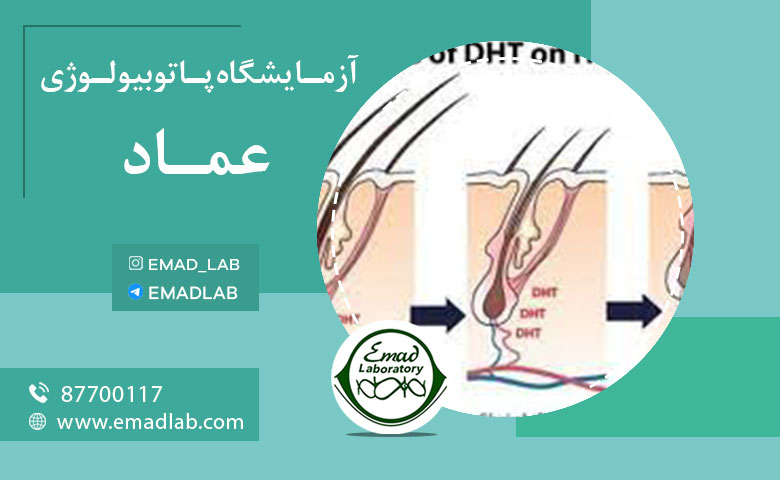 ازمایش ریزش مو