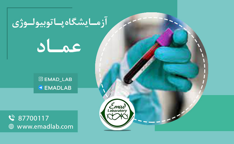 ازمایش سرطان