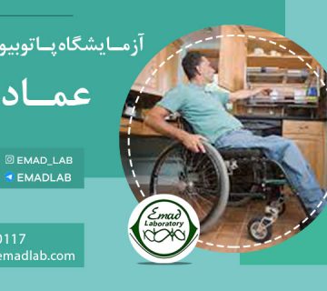 ام-اس-در-خانه