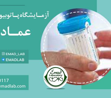 نمونه-گیری-ادرار-در-منزل