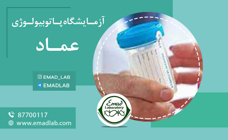 نمونه گیری ادرار در منزل