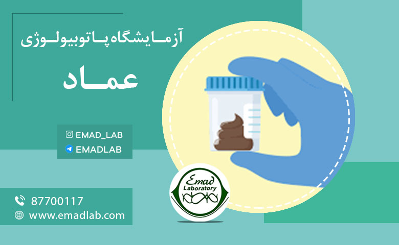 نمونه گیری مدفوع در منزل